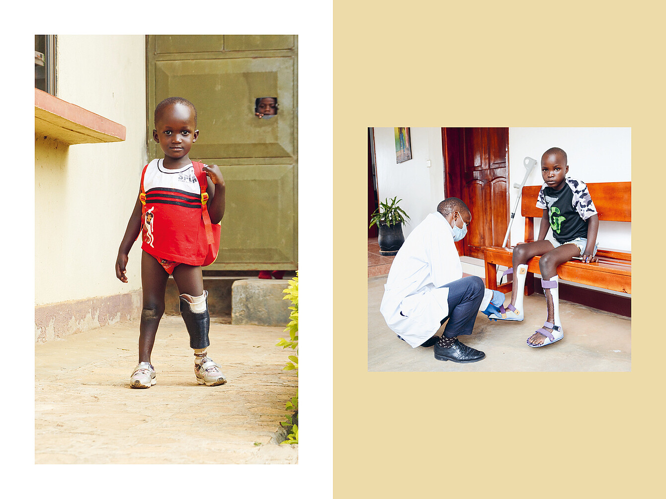 Kind mit rotem T-Shirt und Prothesen an beiden Beinen steht vor einem Gebäude. Arzt kniet vor einem sitzenden Kind mit Beinprothesen in einem Raum mit Holzbänken.