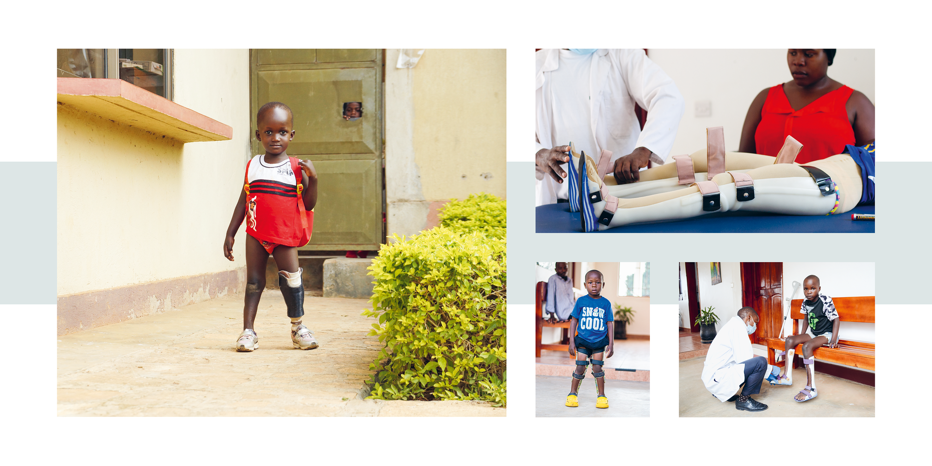 Kind mit Prothesen an beiden Beinen geht auf einem Hof, daneben mehrere Szenen mit medizinischem Personal und Kindern mit Prothesen in Uganda